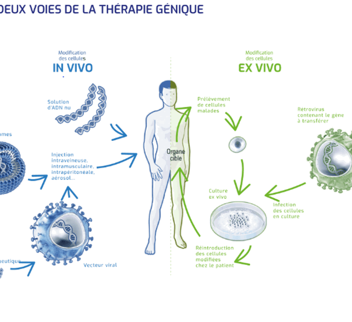Visuel Thérapie Génique